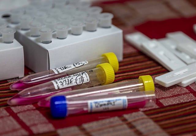 Distt level microlabs for genomic surveillance of Covid-19