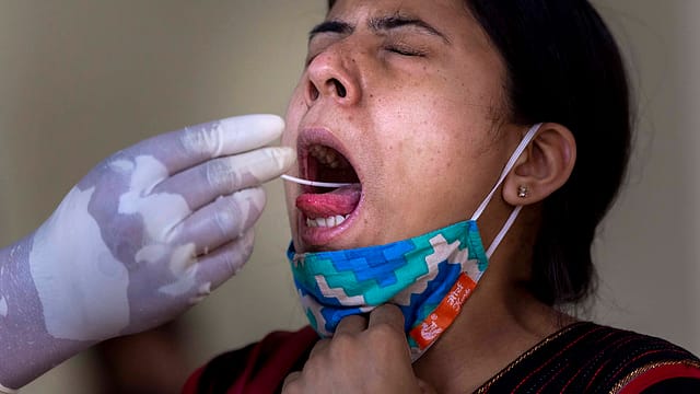 Revenue of diagnostics firms to fall 5-7% on fewer Covid-19 tests: Report Revenue of diagnostics firms to fall 5-7% on fewer Covid-19 tests: Report