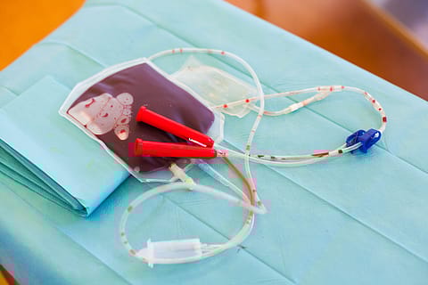 The cord blood banking market in India is worth only ₹300 crore a year and growth over the years has been low.