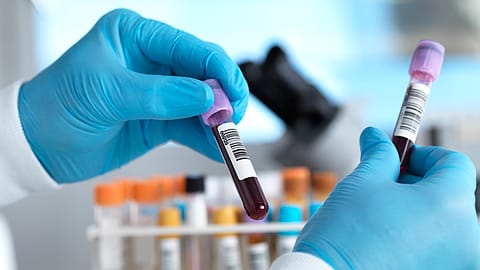 The study measured plastic particles as small as 700 nanometres in human blood.