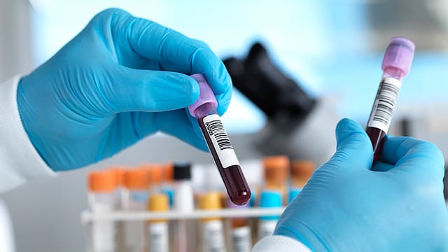 Plastic particles found in human blood for first time Plastic particles found in human blood for first time