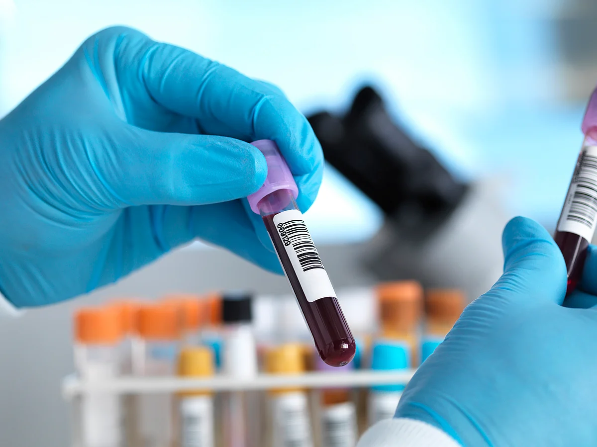 The study measured plastic particles as small as 700 nanometres in human blood.