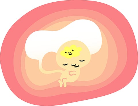 The project was done at less than 1/10th of the costs in western countries.